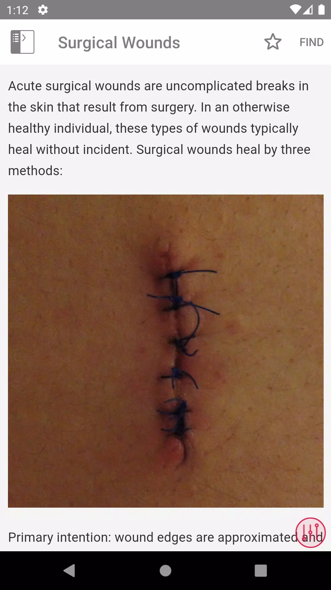 Wound Care MI Visual স্ক্রিনশট 3